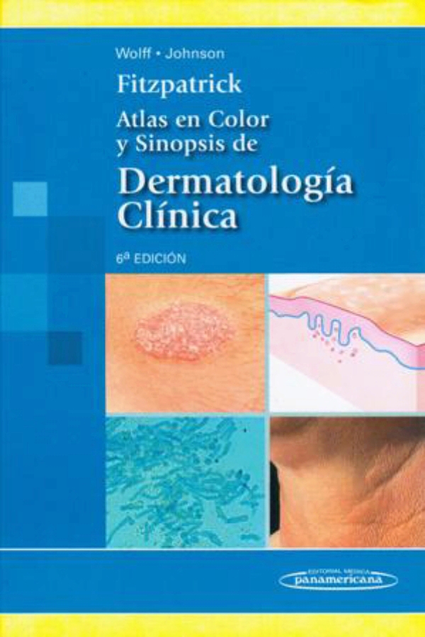 Atlas De Dermatologia Fitzpatrick Pdf File