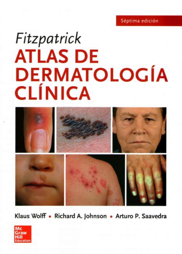 Fitzpatrick Atlas De Dermatología Clínica - 