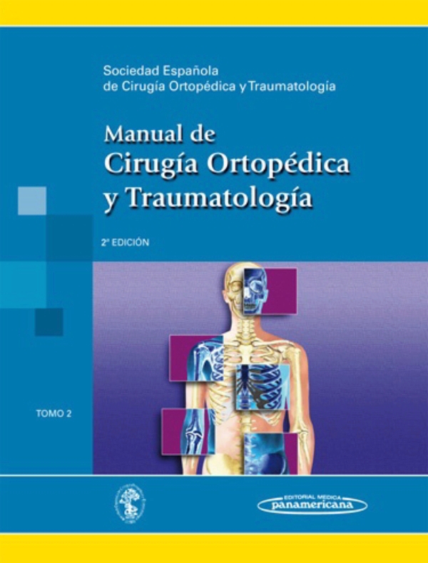 Manual De Cirugía Ortopédica Y Traumatología Vol 2